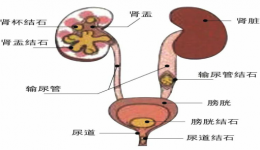 “小手術(shù)”幫你解決“大問題”